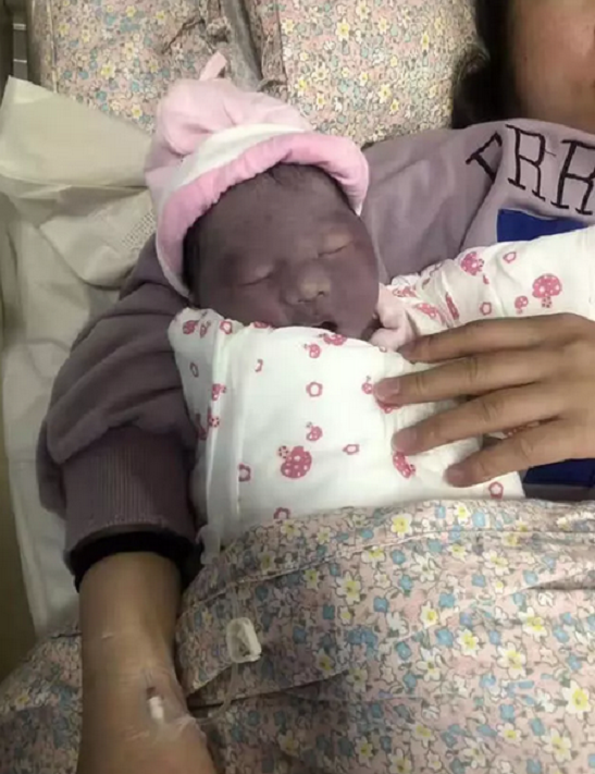 Người mẹ phát khóc khi nhìn con mới sinh tim tím như củ khoai môn, ngoại hình sau 3 tháng mới là điều gây bất ngờ Ảnh 4
