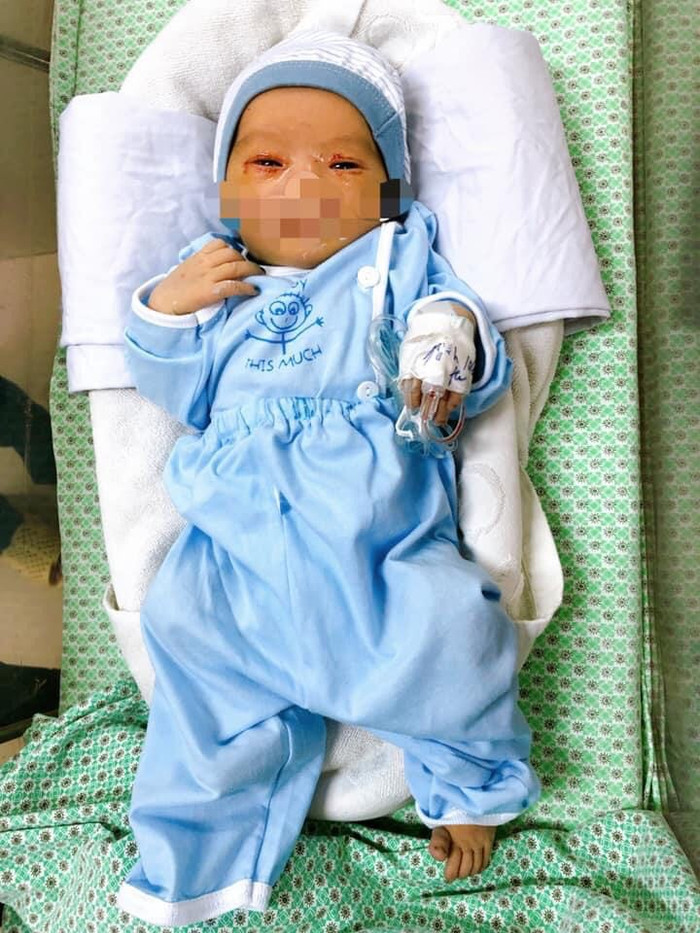 Bé trai bị mẹ bỏ rơi dưới hố gas đã tử vong sau 20 ngày điều trị.