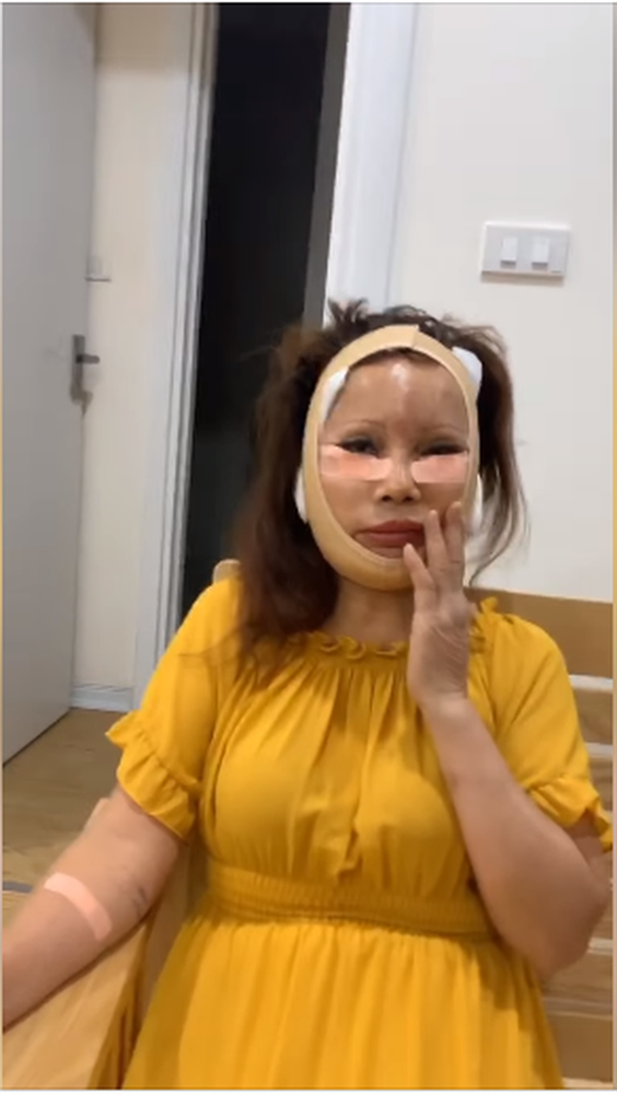 Vừa khoe da căng mịn, 'cô dâu 62 tuổi' lại khiến dân tình hoang mang về chiếc miệng bị méo Ảnh 3