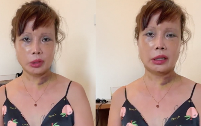 Sẽ tiếp tục nâng ngực sau khi PTTM gương mặt, 'cô dâu 62 tuổi' tuyên bố: 'Có sang thế giới bên kia cũng phải trở thành con ma đẹp' Ảnh 2