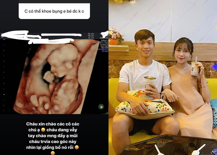 Nhật Linh khoe hình bé Dâu tây đang trong bụng