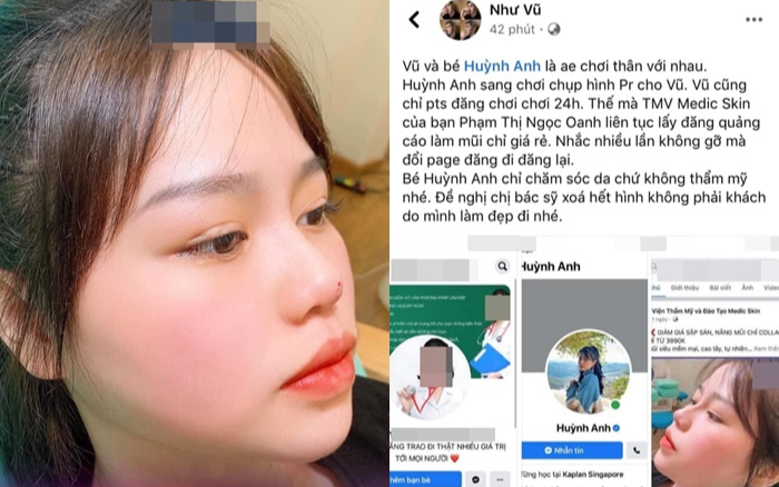 Sau nghi vấn phẫu thuật thẩm mỹ, người yêu Quang Hải đăng bài đính chính Ảnh 2