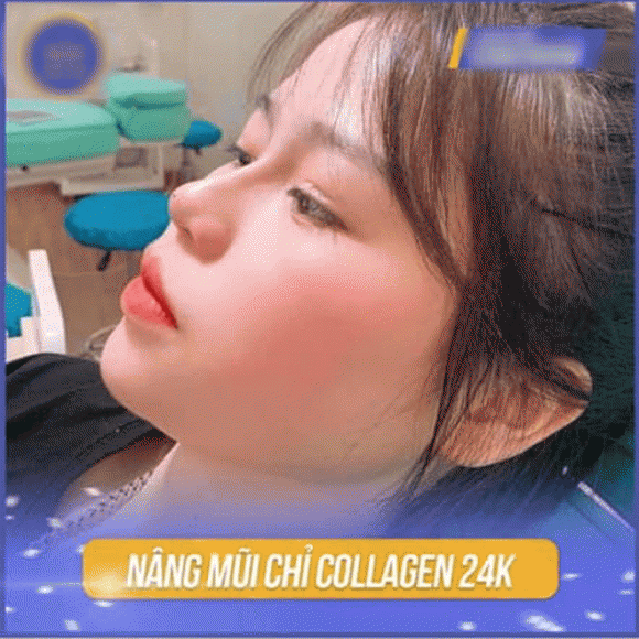 Bị đồn nâng mũi, sửa mặt, bạn gái Quang Hải lập tức lên tiếng Ảnh 4