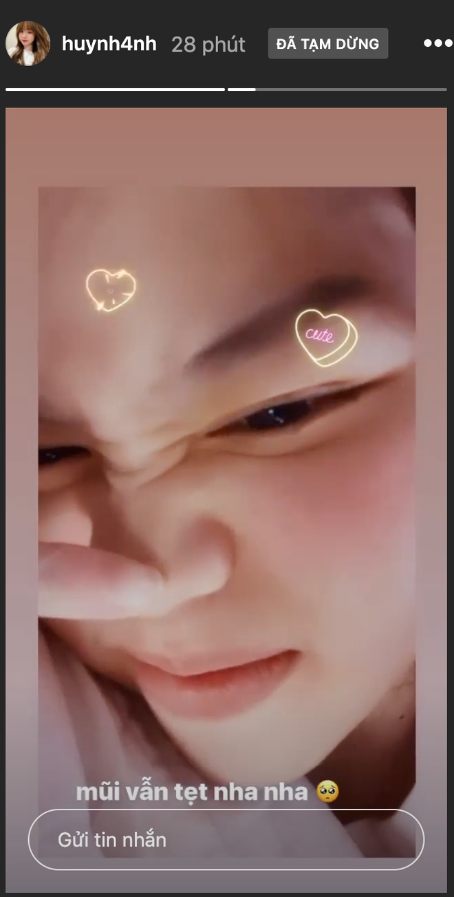 Bị đồn nâng mũi, sửa mặt, bạn gái Quang Hải lập tức lên tiếng Ảnh 5