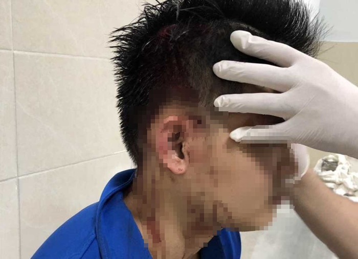 Anh H. phải nhập viện điều trị do thương tích. Ảnh: VietNamNet