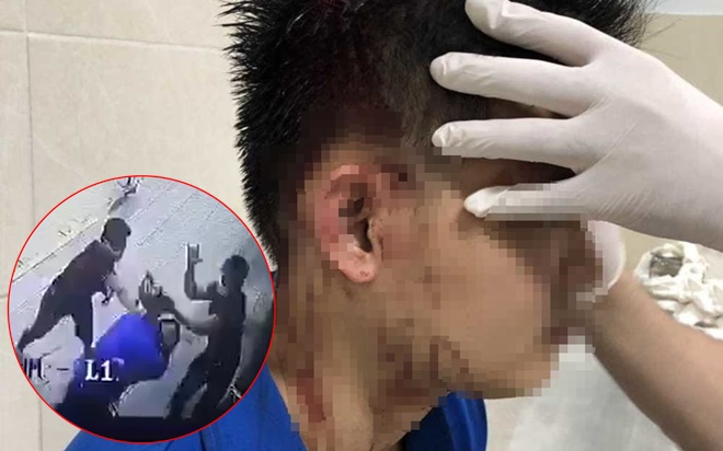 Nhóm người cầm hung khí tấn công một nam thanh niên trước cửa trung tâm thương mại ở Sài Gòn Ảnh 2