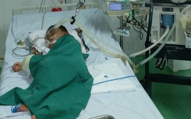 Nghịch tổ ong vò vẽ, một bé trai 4 tuổi bị đốt hơn 80 mũi Ảnh 2