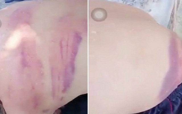 Xác minh vụ người đàn ông đi lang thang, xin ăn trên đường nghi bị đánh bầm dập Ảnh 2