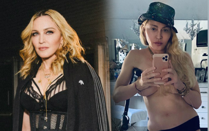 'Nữ hoàng nhạc pop' Madonna gây bất ngờ khi khoe thân hình gợi cảm khó tin ở tuổi 62 Ảnh 2