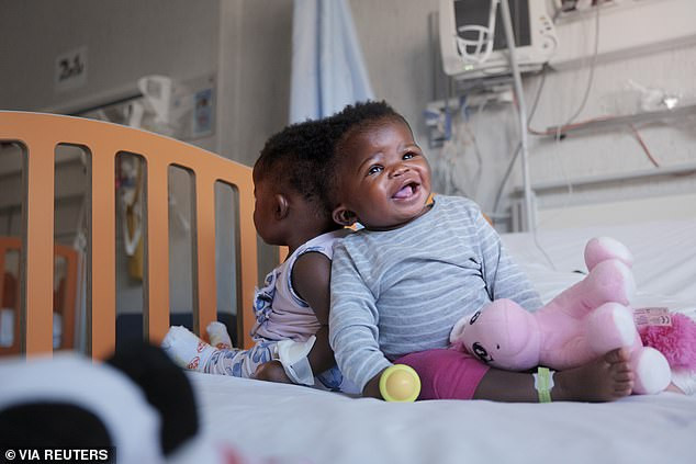 Hai bé đã được phẫu thuật tách hộp sọ.