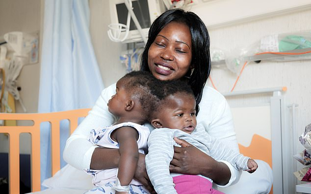 Cặp song sinh dính liền đầu được phẫu thuật thành công Ảnh 2