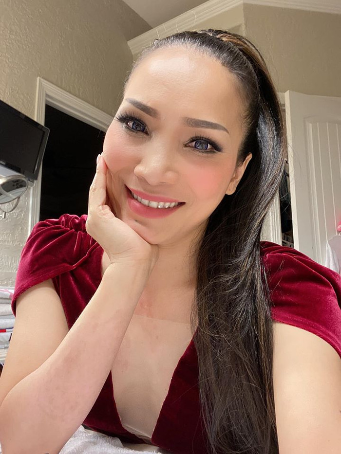 Nhan sắc của Hồng Ngọc sau 1 thời gian bị bỏng: Như một phép màu thần kì Ảnh 4