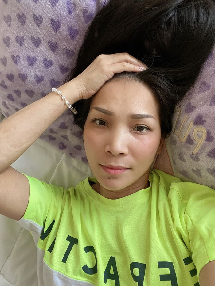 Nhan sắc của Hồng Ngọc sau 1 thời gian bị bỏng: Như một phép màu thần kì Ảnh 3