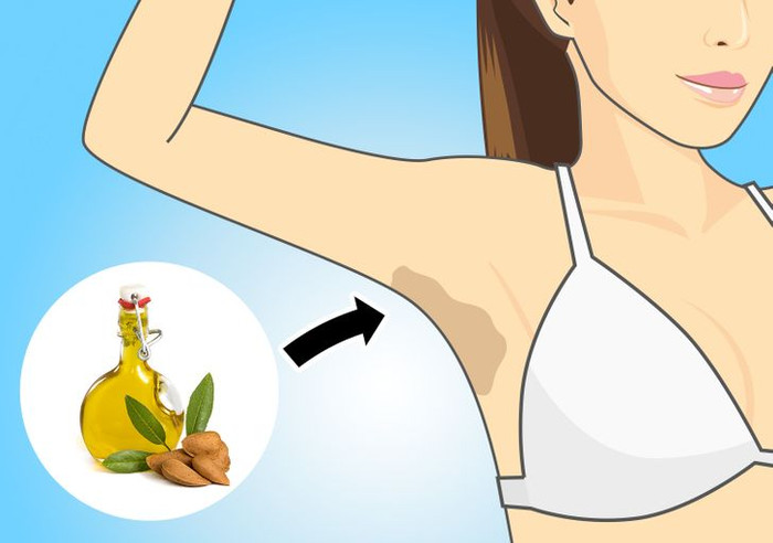 8 cách loại bỏ vết thâm dưới nách cho các nàng tự tin diện bikini Ảnh 7