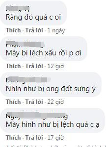 'Thị Nở' Quách Phượng tiếp tục 'trùng tu' nhan sắc nhưng nhận phản ứng ngược từ dân mạng Ảnh 7