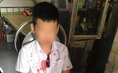 Nhà trường lên tiếng vụ bé trai bị phụ huynh của bạn đánh chấn thương, chảy máu khắp mặt Ảnh 2