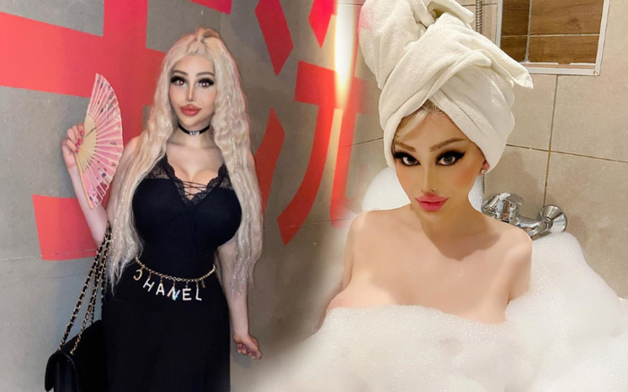 Nhan sắc 'muốn khóc thét' của cô gái chi tiền tỷ phẫu thuật để trở thành búp bê sống Ảnh 2