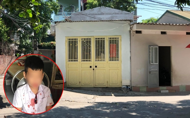 Vợ người đàn ông hành hung bé trai 7 tuổi chấn thương: Chồng tôi chỉ tát cháu sưng mồm thôi Ảnh 2