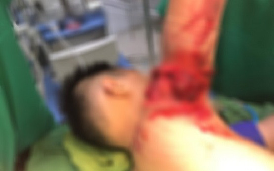 Cháu bé bị thương ở tay