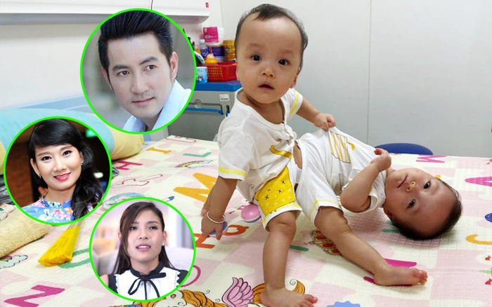Mổ cặp song sinh dính liền phức tạp nhất Việt Nam: Sao Việt và cộng đồng mạng cùng nín thở cầu nguyện! Ảnh 2