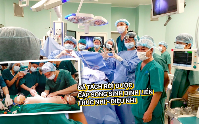 Đã tách rời được cặp song sinh dính liền Trúc - Diệu Ảnh 2