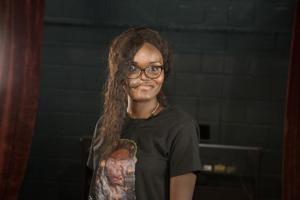 Nghị lực sống phi thường của cô gái ung thư xương bị biến dạng mặt Ảnh 3