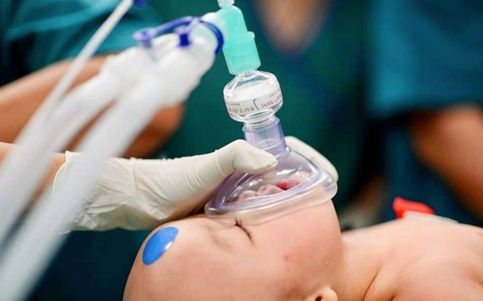 Giải mã ý nghĩa dấu chấm tròn xanh đỏ trên trán hai bé song sinh Trúc Nhi - Diệu Nhi Ảnh 2