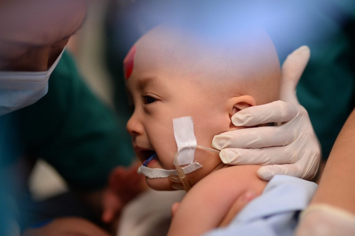 Hai bé song sinh Trúc - Diệu đã tỉnh lại sau ca phẫu thuật Ảnh 3