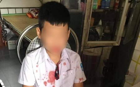 Khởi tố, bắt tạm giam đối tượng hành hung bé trai 7 tuổi vì giật mũ của con ở trường Ảnh 2