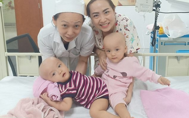 Truyền thông quốc tế chấn động trước ca đại phẫu tách hai bé gái song sinh dính liền quy tụ 100 y bác sĩ Việt Nam Ảnh 2