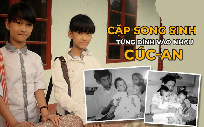 Cặp song sinh Cúc -An từng dính liền vào nhau cách đây gần 20 năm hồi sinh kỳ diệu, xinh đẹp ngỡ ngàng Ảnh 2