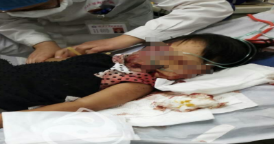 Bé gái 3 tuổi đang điều trị tại phòng chăm sóc đặc biệt.