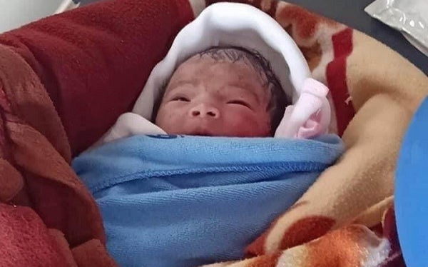 Bé gái sơ sinh bị bỏ rơi ngoài thửa ruộng trong cái nóng gần 40 độ C, bong da do cháy nắng Ảnh 2