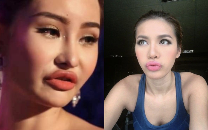 Đang yên lành, hội mỹ nhân Việt lại đua nhau 'bơm môi' tều dầy cộp tức mắt Ảnh 2