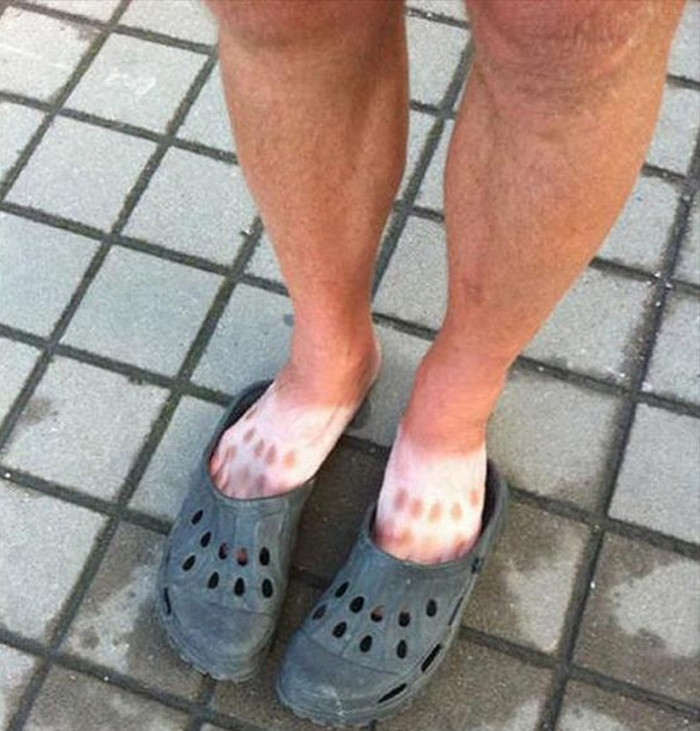 'Cười nghiêng ngả' với loạt ảnh gương mặt cháy nắng thành hình khẩu trang mùa 'Cô Vy' Ảnh 8