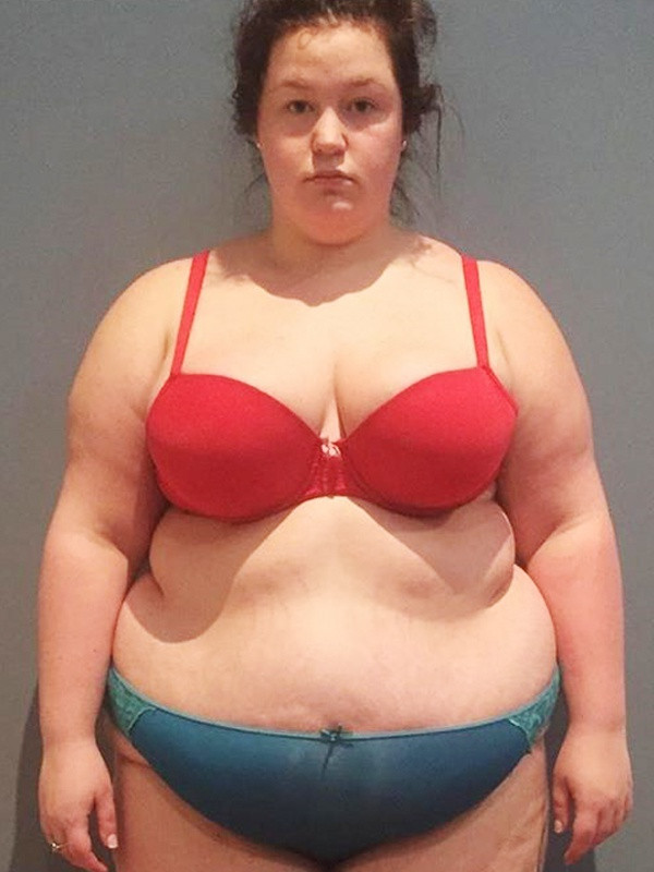 Thân hình quá khổ của Alida còn khiến cô thường xuyên bị bạn bè bắt nạt dẫn đến trầm cảm