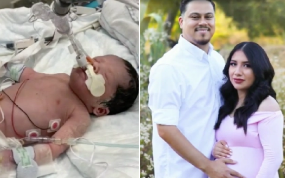 Bé gái được mổ lấy từ tử cung người mẹ qua đời vì tai nạn Ảnh 2