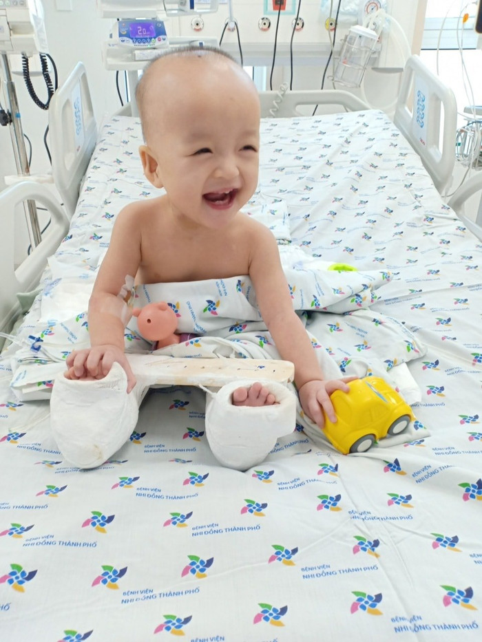 Trúc Nhi - Diệu Nhi tròn 1 tháng phẫu thuật tách dính: 'Tương lai con tốt đẹp trong hình hài mới và sẽ không bao giờ bị kì thị' Ảnh 3