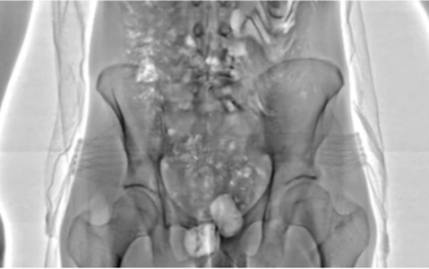 Máy quét an ninh thế hệ mới giúp phát hiện 55 phạm nhân lén mang 'hàng cấm' vào tù Ảnh 2