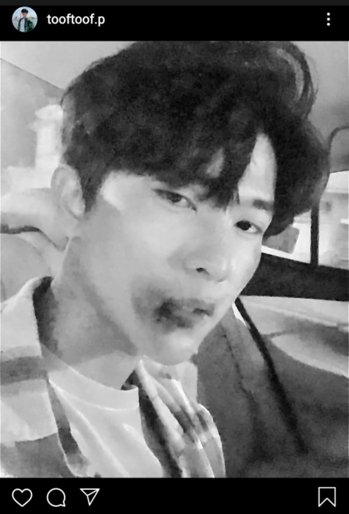 Toof.P gây xôn xao với bức ảnh thương tích đầy mặt, Tùng Maru có động thái khiến fan chú ý Ảnh 4