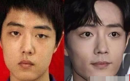 Vừa trở lại thành công với hoạt động livestream, Tiêu Chiến lại gặp sóng gió khi bị tố giác phẫu thuật thẩm mỹ? Ảnh 2