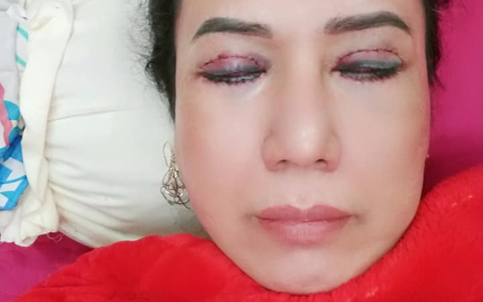 'Cô Minh Hiếu' khiến dân tình xôn xao khi công khai hình ảnh phẫu thuật thẩm mỹ Ảnh 2