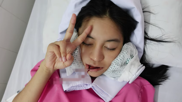 Gò má trở thành bộ phận tiếp theo để hotgirl Trang Anna 'đại tu nhan sắc' Ảnh 3