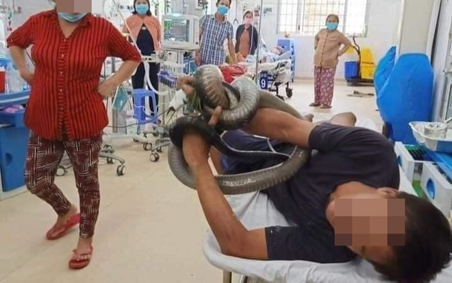 Bị rắn hổ mang cắn, người đàn ông mang luôn 'hung thủ' vào bệnh viện Ảnh 2