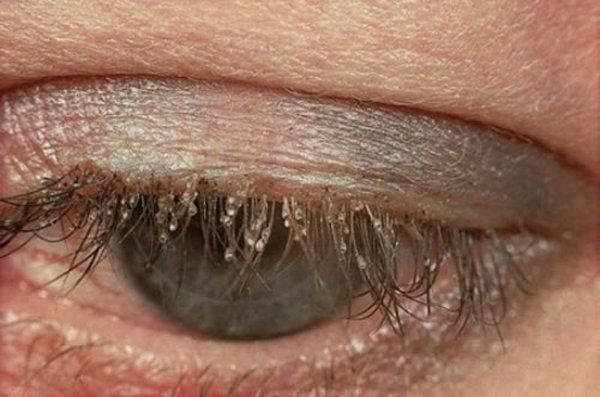 Những pha ở bẩn kinh hoàng khiến ai trông thấy cũng muốn 'ngất xỉu' Ảnh 3