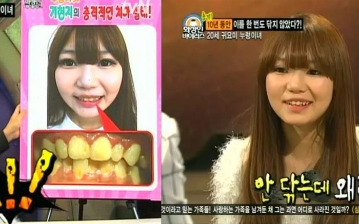 Những pha ở bẩn kinh hoàng khiến ai trông thấy cũng muốn 'ngất xỉu' Ảnh 2