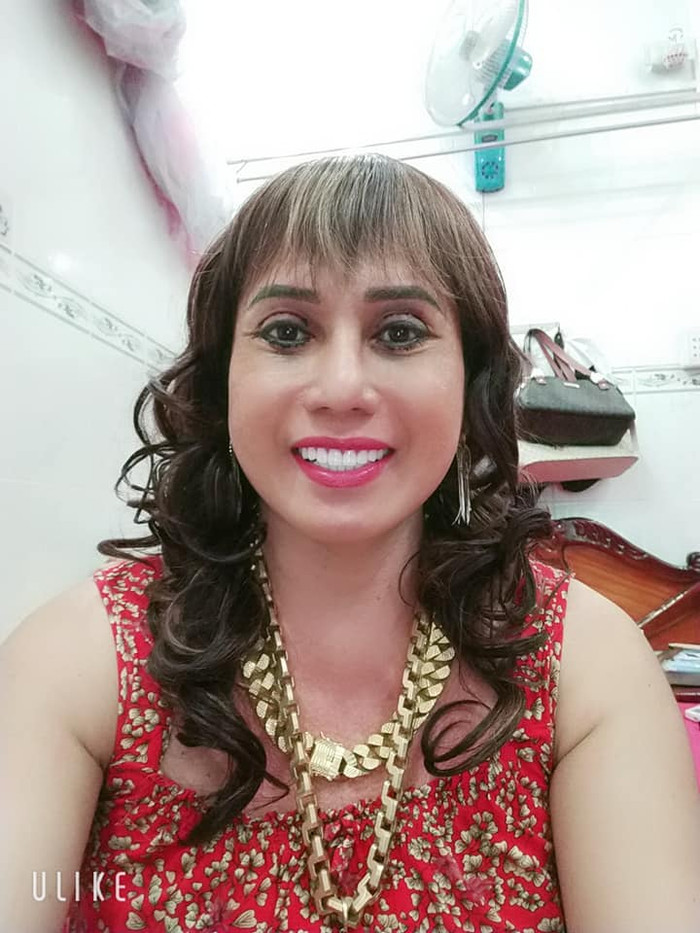 Hậu phẫu thuật thẩm mỹ, 'cô Minh Hiếu' lần đầu livestream với ngoại hình khác lạ Ảnh 5