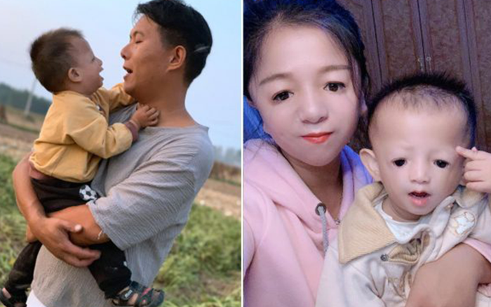 Cô gái 'mặt mỏ chim' rơi nước mắt hối hận vì điều này sau khi kết hôn Ảnh 2