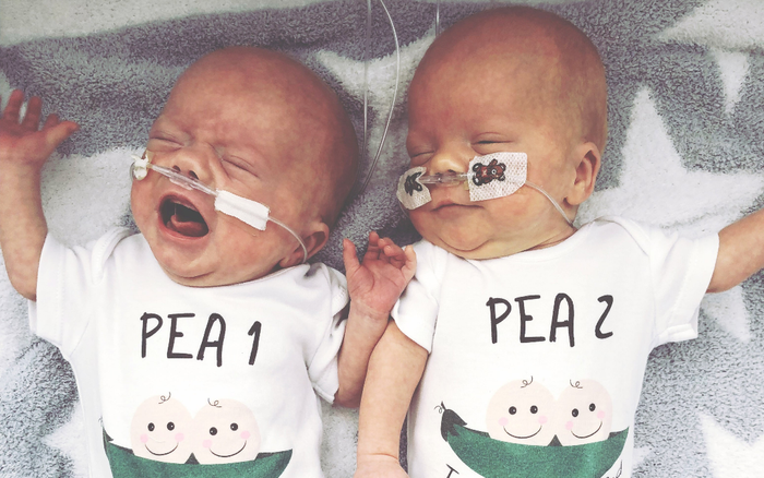 Sản phụ đang chuyển dạ thì hết đau đẻ, hai bé sinh đôi cách nhau hẳn 2 ngày Ảnh 2