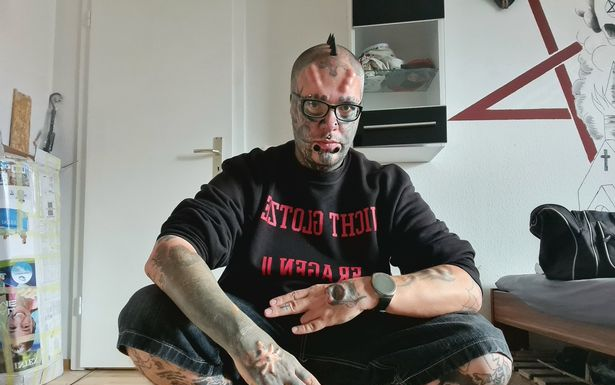 'Dị nhân' phẫu thuật thẩm mỹ 17 lần, cắt bỏ tai để trông giống đầu lâu Ảnh 2